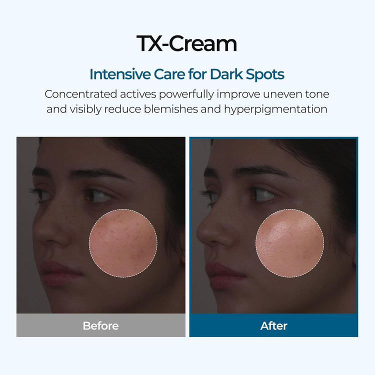 GlowFade™ TX Tranexamic Acid Cream – Korean Anti-Pigmentation & Freckle Corrector for Clear, Even-Toned Skin (50ml)