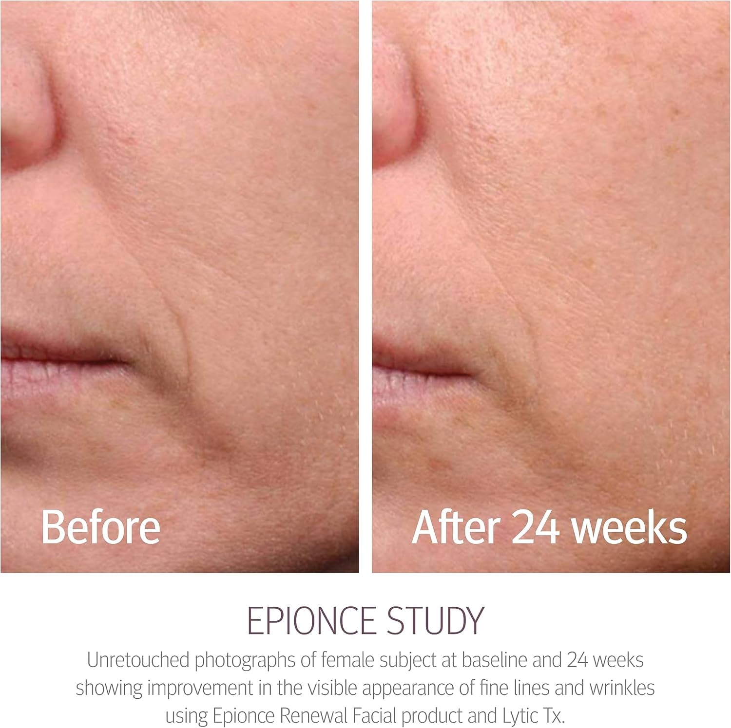 Renewal Facial Lotion - Face Moisturizer for Women & Men, Face Lotion, Glycerin, Olive Oil & Avocado Oil Facial Moisturizer for Normal Skin