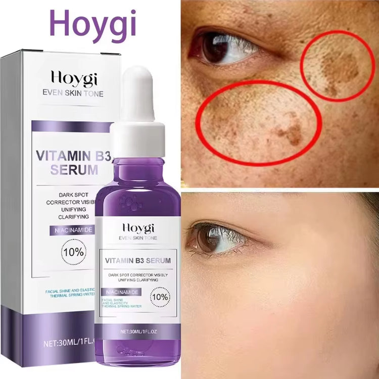 GlowFade™ Spotless Radiance Skin Brightening Serum
