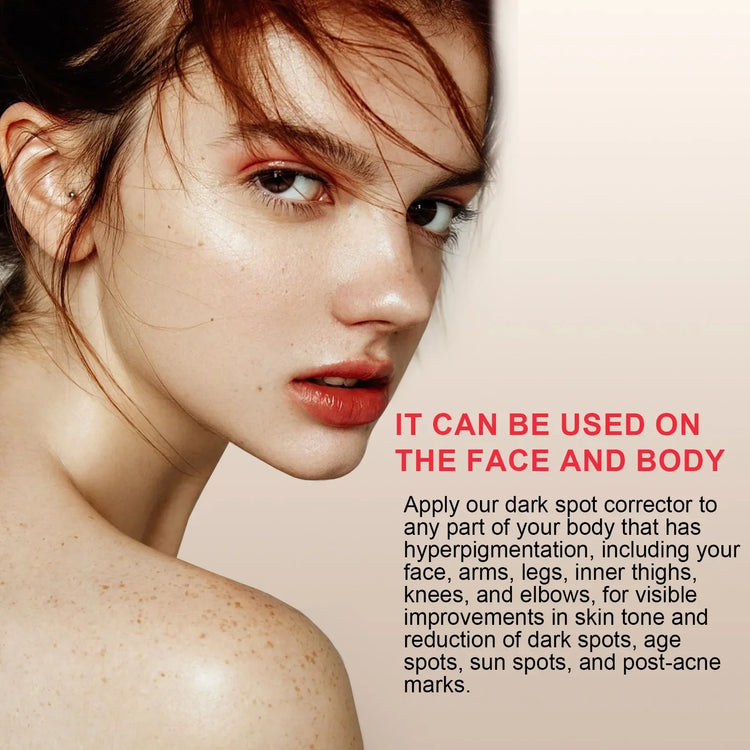 Melanin Correcting Serum for Pigmentation Repair and Brightening, Reducing Melasma and Dark Spots while Combating Aging and Fading Freckles