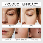 Revitalize Your Skin with Oligopeptide Micro Needle Serum - Hydrating Hyaluronic Acid Essence for Sensitive Skin