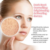 Melanin Correcting Serum for Pigmentation Repair and Brightening, Reducing Melasma and Dark Spots while Combating Aging and Fading Freckles
